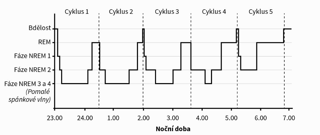 / Hypnogram je výsledkem interprace polysomnogramu odborníkem (polysomnogram neodpovídá tomuto hypnogramu) /